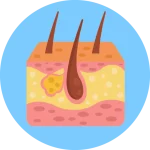 رادیوتراپی درمان سرطان‌ پوست